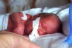 World Prematurity Day 2027