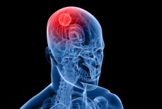 World Brain Tumor Day 2026